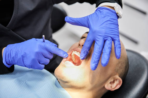 Best Emergency Treatment for Oral Infections in Rittman, OH