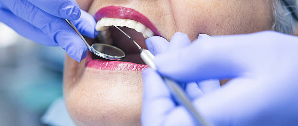 Best Emergency Dental Care for Sports Injuries in Rittman, OH